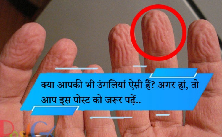 क्या आपकी भी उंगलियां ऐसी हैं? अगर हां, तो आप इस पोस्ट को जरूर पढ़ें..